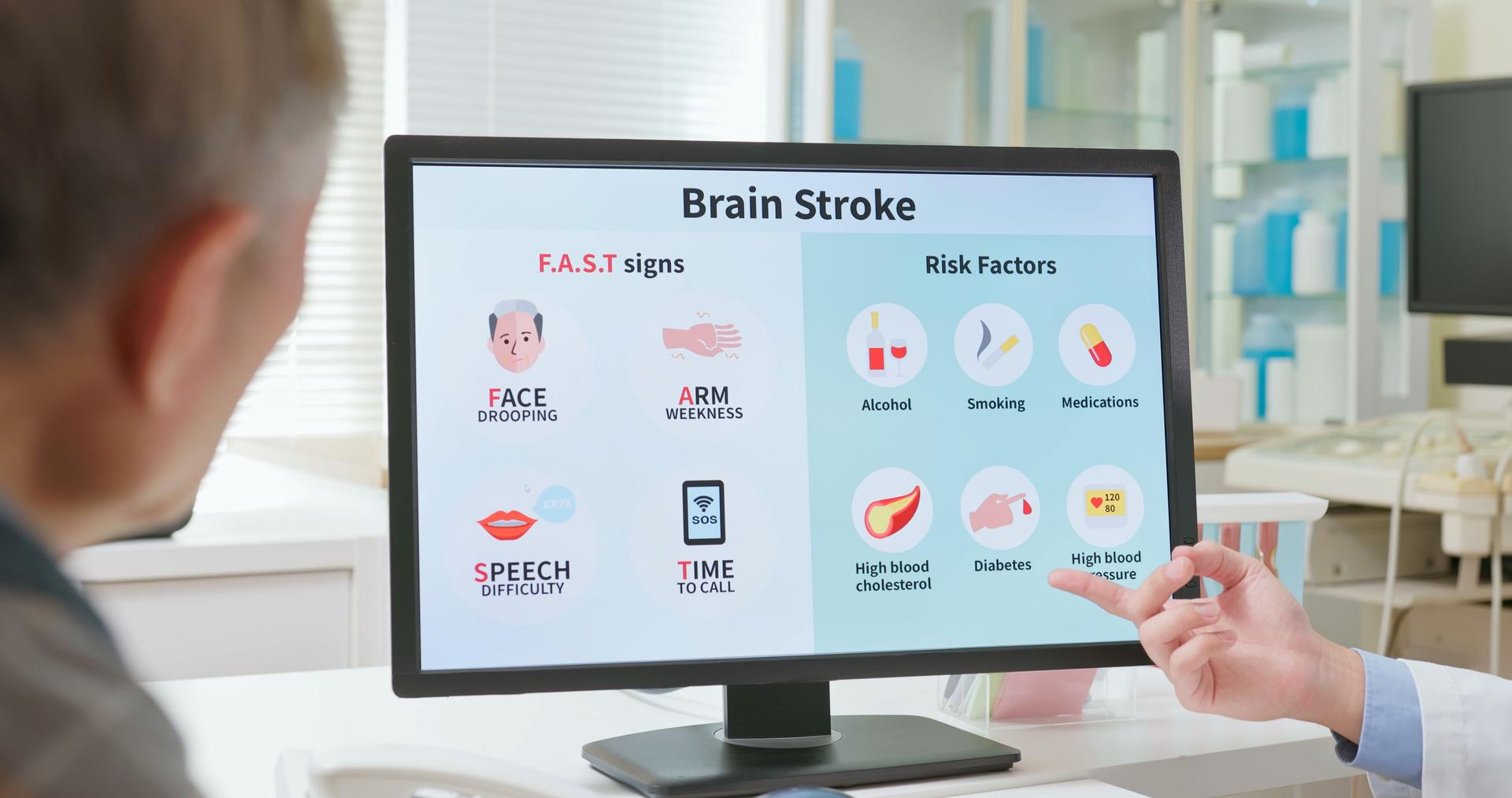 doctor explains stroke risks